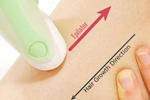 How to Use an Epilator (Step-by-Step Guide)