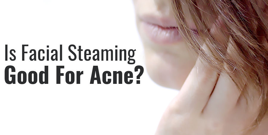 how facial steaming improves acne