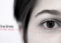 How To Get Rid Of Fine Lines Under Eyes: Preventing Eye Wrinkles