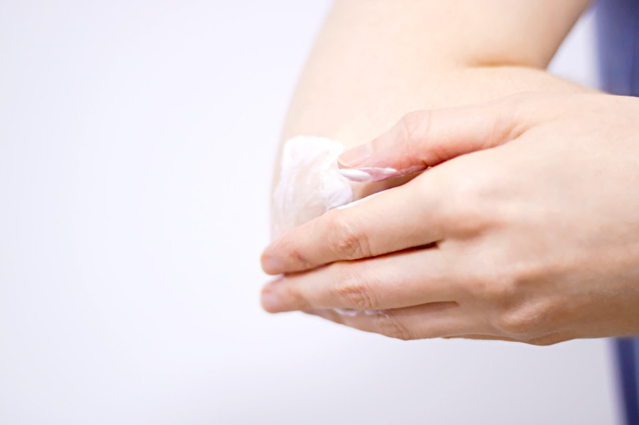 moisturizing cream on cracked elbows
