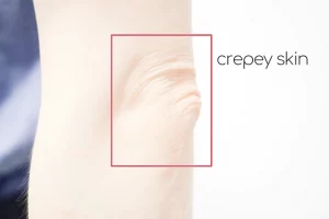 10 Best Lotions for Crepey Skin on Arms and Legs